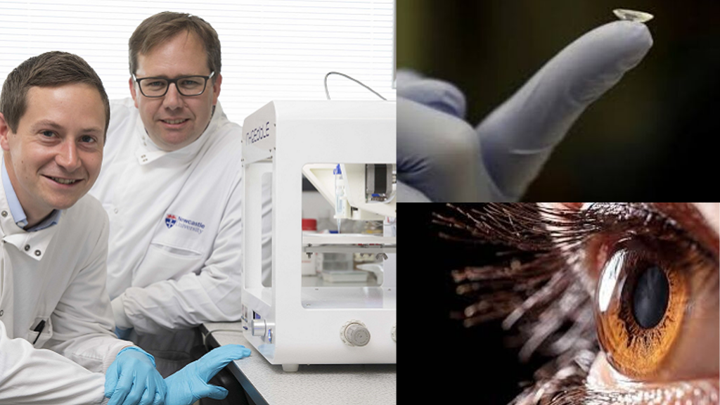 3D printed Bio-ink Human Cornea