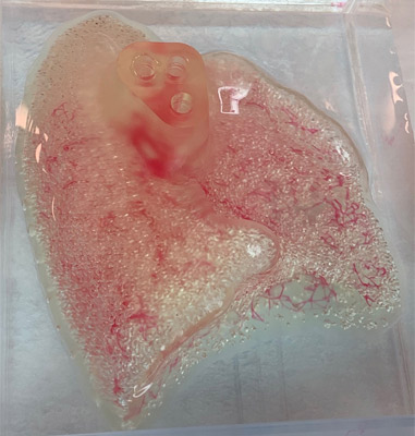 CollPlant and United Therapeutics Expand their Collaboration to Include 3D Bioprinting